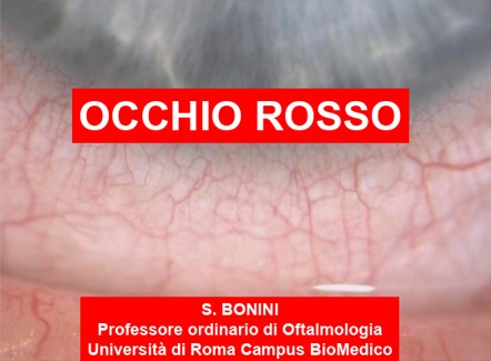 Il trattamento dell'occhio rosso