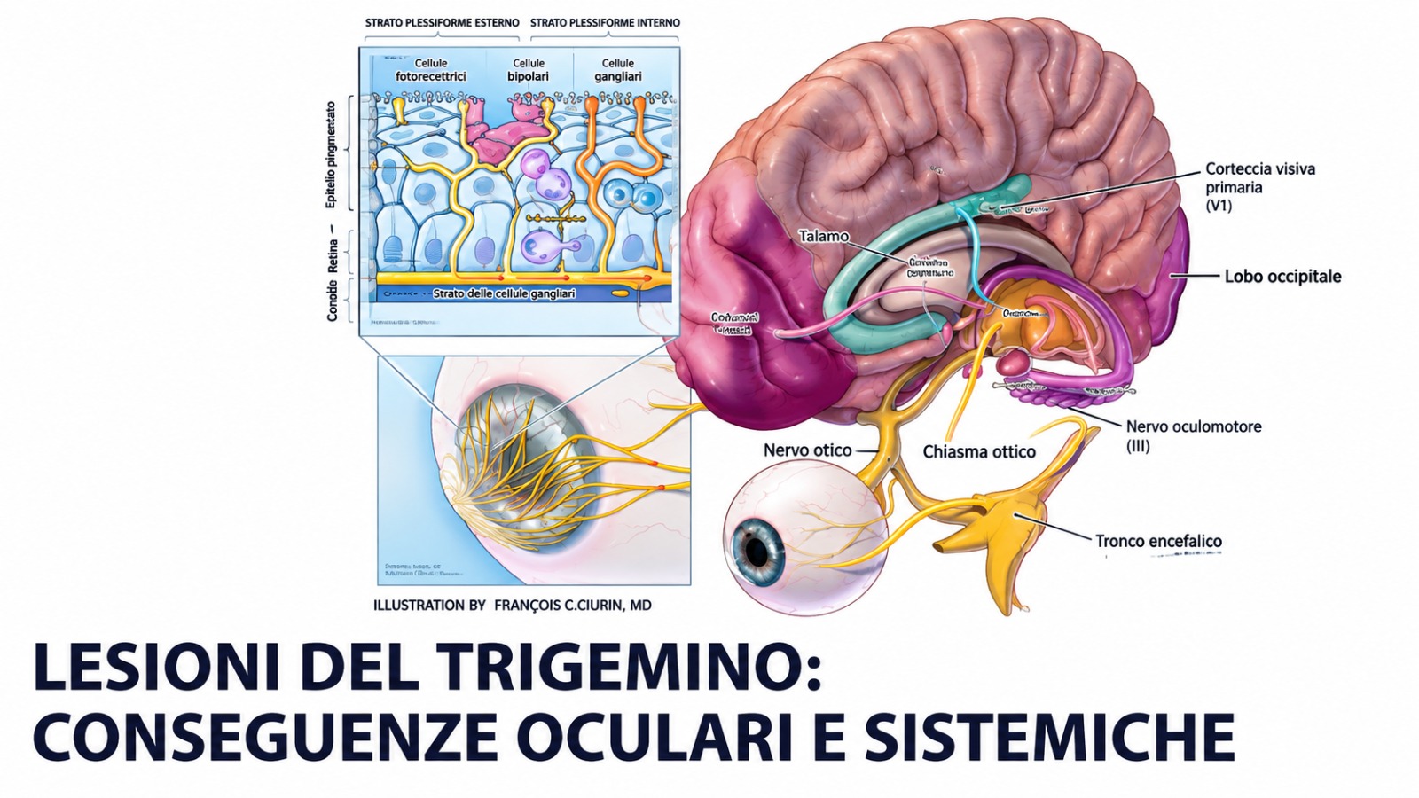 Lesioni del trigemino conseguenze oculari e sistemiche